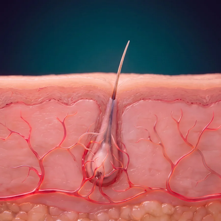 Medical illustration: around month three a fine new hair emerges from the transplanted follicle