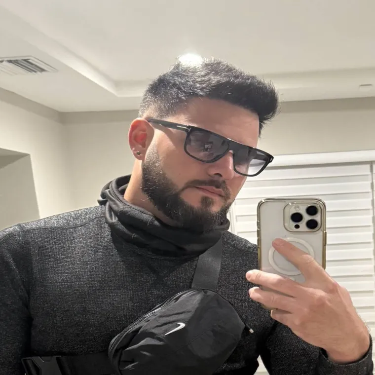 Super full hair restoration, after, everyday, Hair Transplant Design Tampa